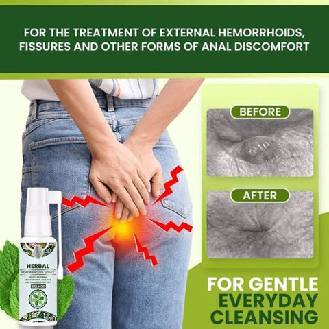 30ml Hemorrhoid Piles Treatment Spray Natural