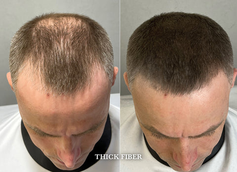 Hair Building Fiber For Men & Women