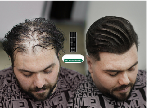 Hair Building Fiber For Men & Women